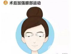 雙眼皮手術(shù)的優(yōu)點(diǎn)和風(fēng)險(xiǎn)有哪些