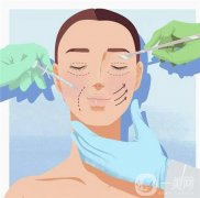 雙眼皮術(shù)后疤痕增生是否有前兆