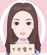 下巴整形手術(shù)的注意事項(xiàng)有哪些？