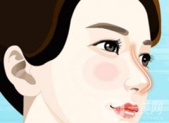 么避免膨體隆鼻的副作用