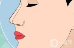 鼻小柱延長(zhǎng)是延長(zhǎng)什么地方