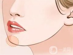 玻尿酸注射下巴后是否會(huì)變硬？