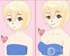 副乳切除術(shù)是否會影響乳房？