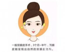 割雙眼皮的風(fēng)險可能有哪些