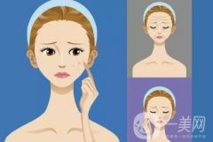 光子嫩膚效果是否持久，是否會留下疤痕