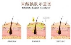 彩光嫩膚后化妝有哪些注意事項(xiàng)