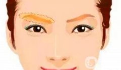 常見(jiàn)眉弓整形方法有哪些呢？