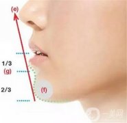 雙下巴線雕的步驟是怎樣的