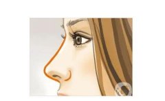 鼻小柱延長手術(shù)失敗后如何進行修復(fù)呢？