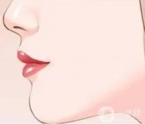 玻尿酸注射隆鼻的注意事項(xiàng)