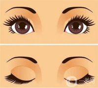 雙眼皮納米無(wú)痕與全切的不同