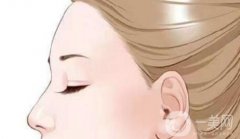 提眉手術與雙眼皮手術需要間隔多久？