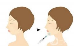 下巴注射玻尿酸后為什么會出現(xiàn)硬塊呢？