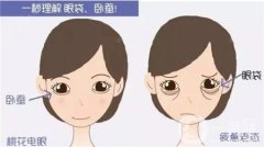 眼袋修復(fù)的方法有哪些？