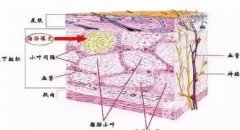 自體脂肪豐蘋果肌的優(yōu)點(diǎn)