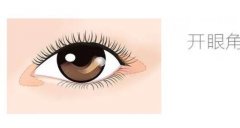 開眼角手術(shù)后吸煙的危害