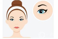 開眼角術(shù)后洗臉有哪些注意事項(xiàng)