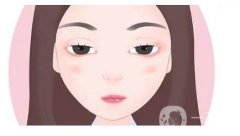 開(kāi)眼角拆線后的注意事項(xiàng)