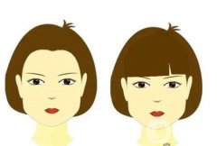 磨骨手術(shù)后的恢復過程