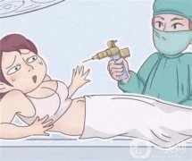 哪些人群應(yīng)避免注射溶脂針呢？