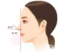 膨體隆鼻后取出是否真的困難？