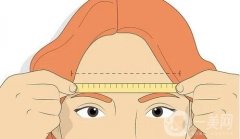 切眉手術(shù)的注意事項(xiàng)有哪些