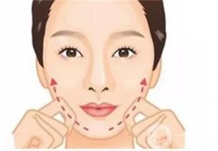 顴骨墊高的恢復(fù)時(shí)間長(zhǎng)嗎