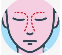 如何避免鼻頭縮小手術(shù)后的增生呢？