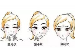 如何預(yù)防熱瑪吉導(dǎo)致的面部凹陷