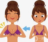 乳暈縮小手術(shù)的效果如何呢？