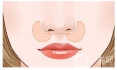 鼻頭縮小手術(shù)的風(fēng)險(xiǎn)與副作用