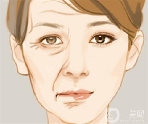 天津等離子除皺價(jià)格一般要多少